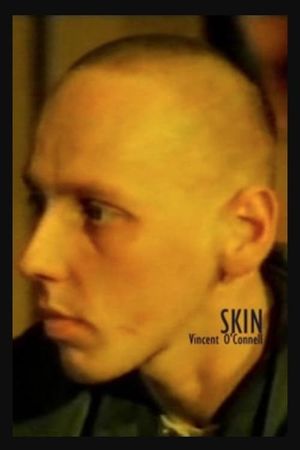 Skin's poster