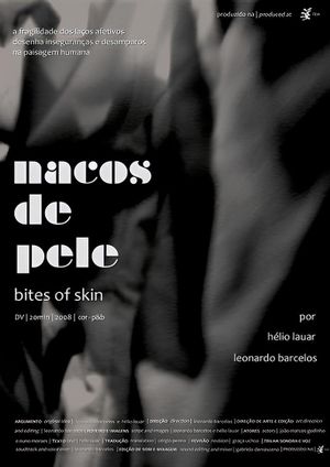 Nacos de pele's poster