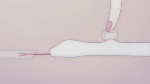 Anxious Body's poster