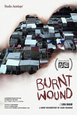 Burnt Wound's poster