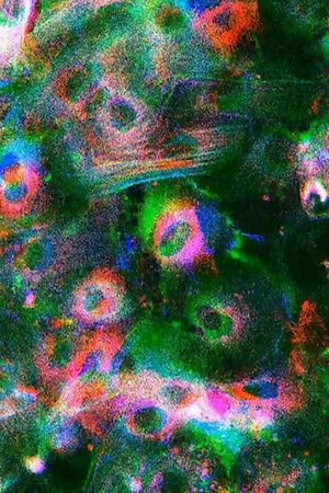 Wound's poster