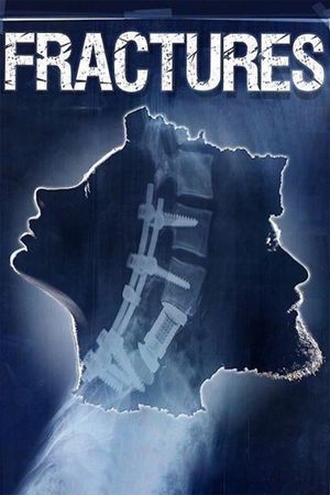Fractures's poster