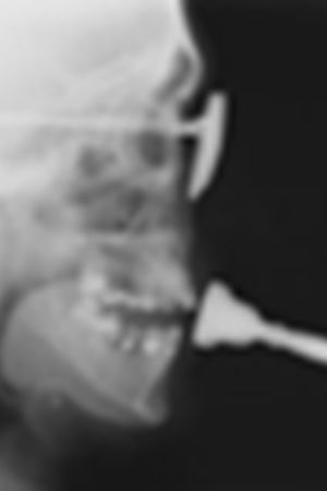 Studies in Diagnostic Cinefluorography's poster