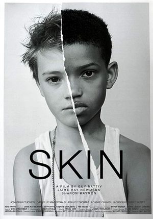 Skin's poster